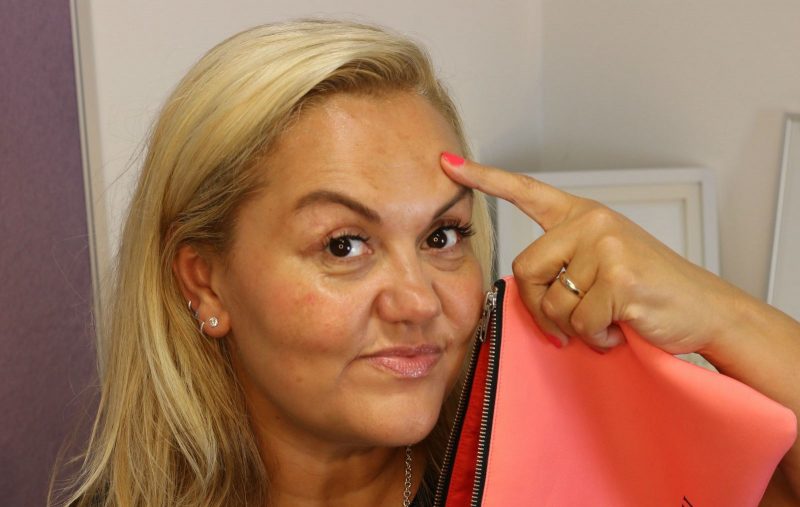 HOW I'M DEALING WITH MY PIGMENTATION